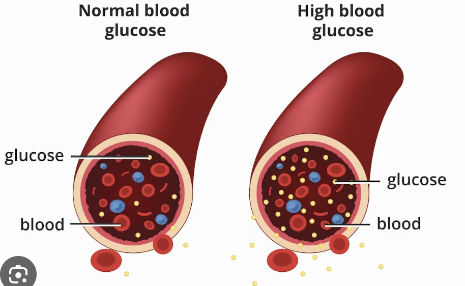 Hoe ziet diabetes eruit?