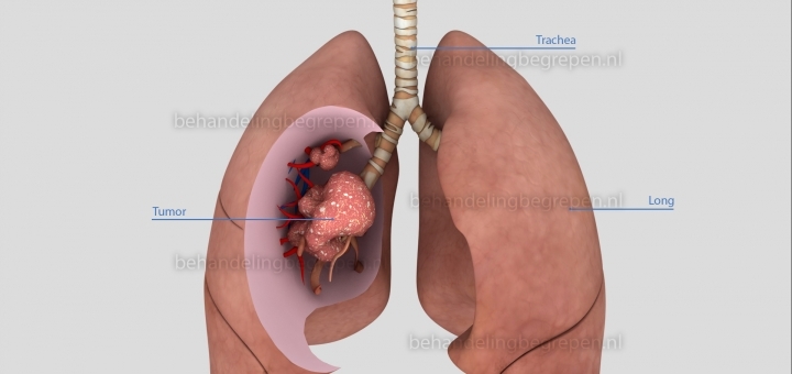 Afbeelding 17, Bron: Smarthealth
