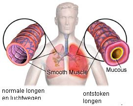 Bron: gezondheid.be