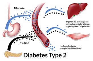 Afbeelding 8: Diabetes type 2 bloedsuikerspiegel