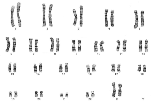 Chromosomen van een vrouw