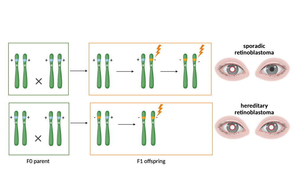 Figure 9.5 Inheritance of an allele with a mutation in the RB1 gene results in an increased risk of hereditary retinoblastoma. Development of retinoblastoma requires the deletion of both copies of the tumour suppressor gene RB1. In hereditary retinoblastoma, the damaged gene is inherited from one parent, and a single mutation is sufficient to develop the disease (bottom row). In sporadic retinoblastoma, two independent mutations must occur during life.