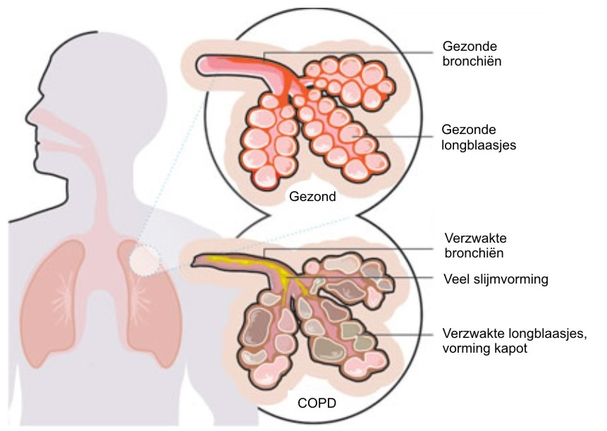 Bron: https://biologielessen.nl/index.php/dna-64/2193-longblaasjes