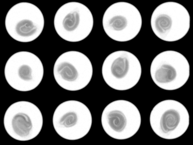 Met behulp van röntgen kun je het embryo in het zaad beoordelen. Bron: Incotec