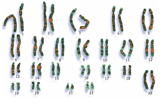 Chromosomenportret