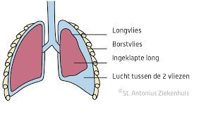 Bron: Antoniusziekenhuis.nl