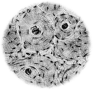 Beenweefsel bekeken onder een elektronenmicroscoop.