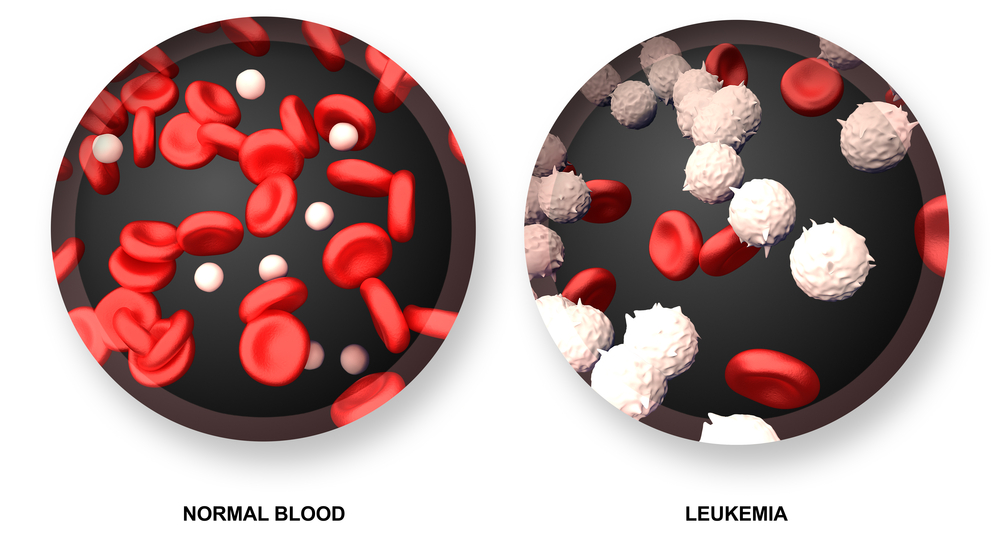 afbeelding: Shutterstock/decade3d - anatomy online