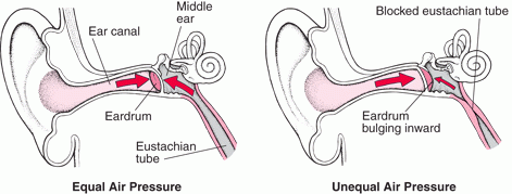 When the air pressure is not equal on both sides of the eardrum something happens. The Eustachian tube closes and the eardrum bulges inward or outward (depending on which side the pressure is higher).