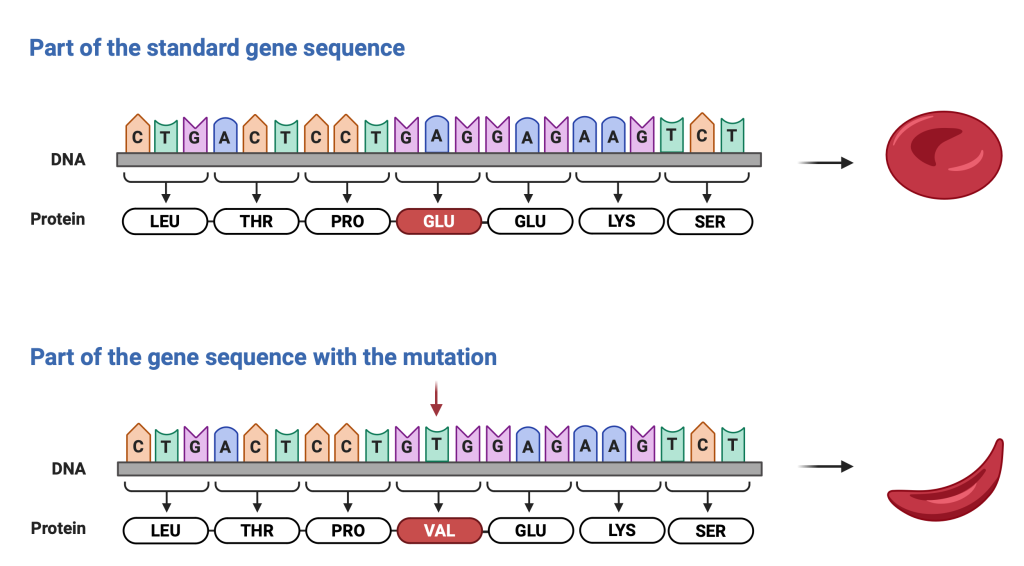 Figure 5.5 A mutation in the molecule of haemoglobin causes sickle cell disease. A base pair substitution from adenine to thymine, results in a missense mutation, where the amino acid glutamic acid is replaced with valine. The result is that haemoglobin S is formed, not haemoglobin A and so the red blood cell is distorted into a sickle, or crescent, shape.