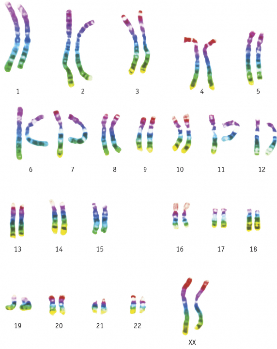 chromosoomparen