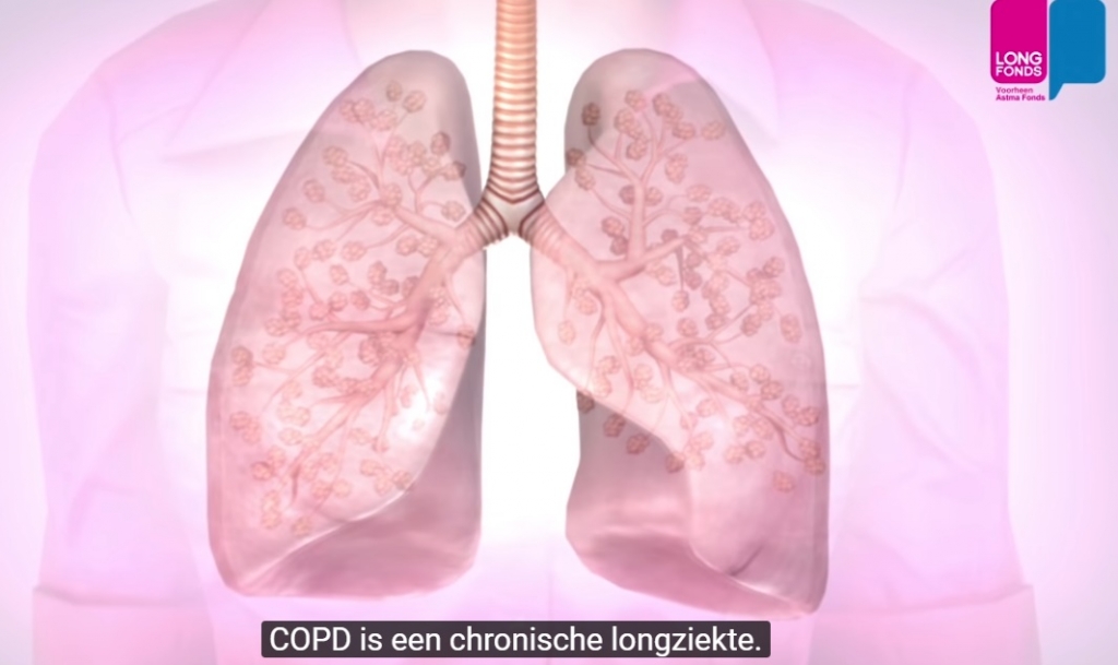 Afbeelding 13, Bron: Longfonds