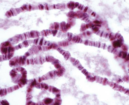 Afbeelding 1 chromosomen onder een microscoop bron: Biologie voor jou