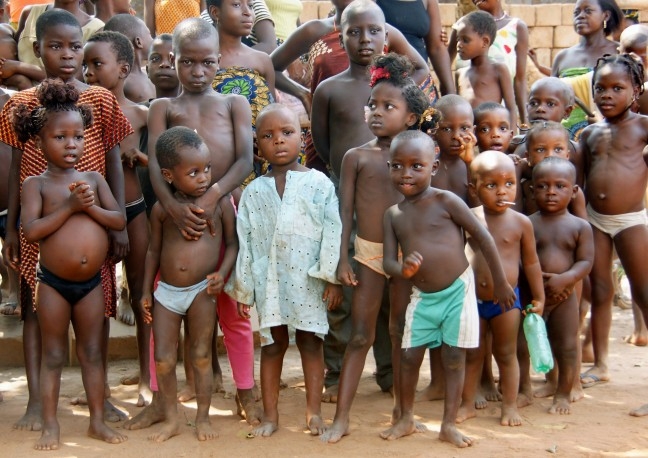 Ondervoede kinderen uit Centraal- Benin.