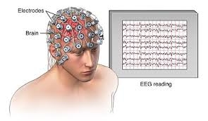 Elekro-encefalografie. Bron: lib.ugent.be