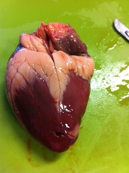 Het hart