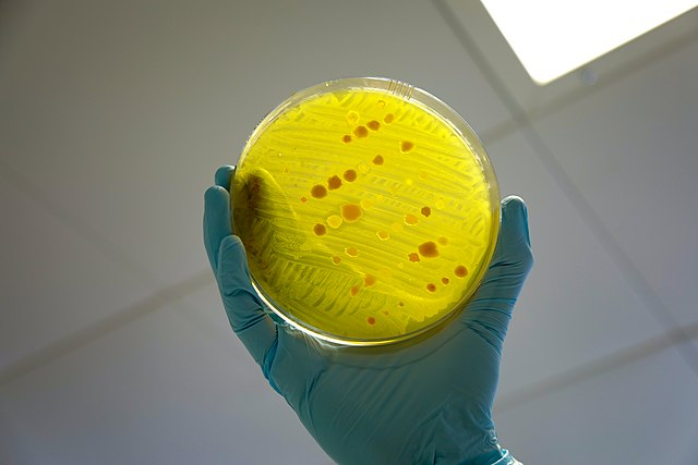 Bacteriën in een petrischaal