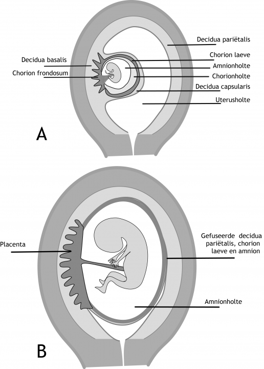 Figuur 7.9 De ontwikkeling van de amnionholte en vruchtvliezen tijdens de zwangerschap. (A) 8 weken na conceptie. (B) 12 weken na conceptie. Villi aan de embryonale pool (chorion frondosum), ontwikkelen zich steeds verder en de villi aan de niet-embryonale pool (chorion laeve) verdwijnen. Ook in de decidua is er nu een verschil zichtbaar tussen de decidua die grenst aan het chorion frondosum en tussen de decidua die grenst aan het chorion laeve. Aan de kant van het chorion frondosum zijn de cellen groot en bevatten veel lipiden en glycogeen. Deze laag, de decidua basalis of deciduale plaat, is hecht verbonden met het chorion frondosum. De decidua die over de niet-embryonale pool ligt wordt decidua capsularis genoemd, omdat deze laag geleidelijk verder uitgerekt wordt en degenereert. Bij het toenemen in grootte van de amnionholte komen het chorion laeve en de decidua capsularis tegen de wand van de uterus (die niet bij de implantatie van de blastula was betrokken, decidua parietalis) te liggen en vergroeien hiermee.