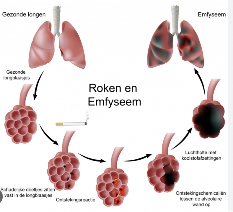De  overgang van de longen van gezond naar beschadigd als het wordt gerookt