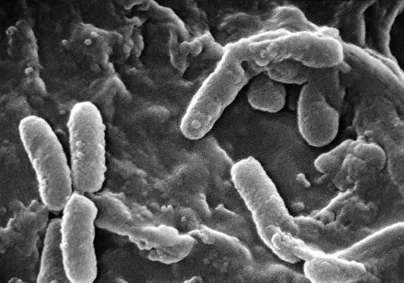 Dit is hoe een bacterie eruit ziet onder een microscoop