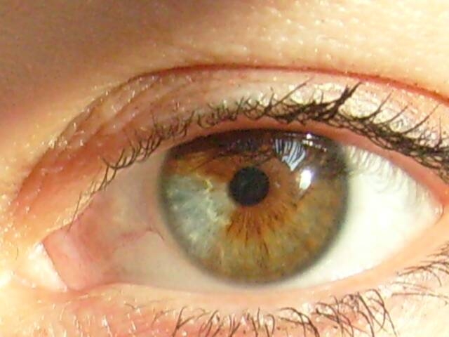 Afbeelding 4 de buitenkant van het oog