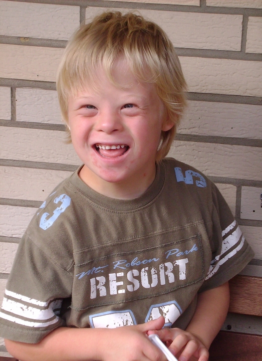 Afbeelding 2 een jongen met het downsyndroom bron: commons.wikimedia.org