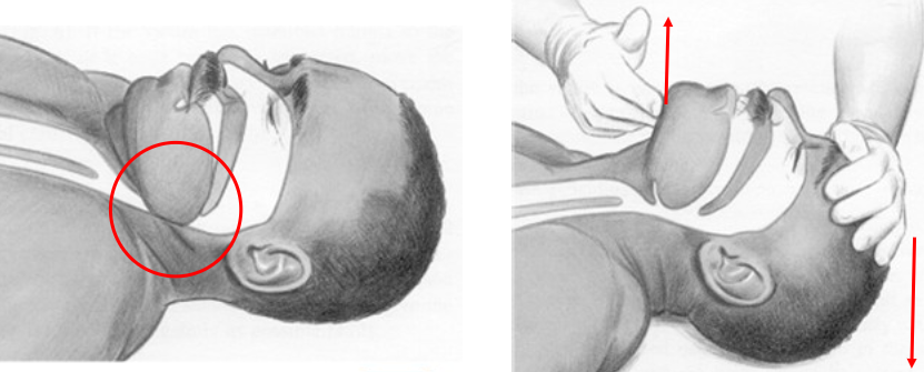 Kantel het hoofd naar achter en de kin omhoog