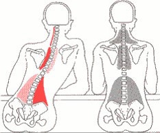 Hoe zit jij? Bron:http://www.optimalegezondheid.com/zithouding