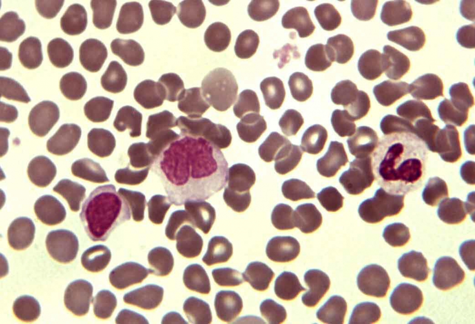 bloeduitstrijkje met erythrocyten en leucocyten