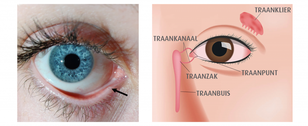 De traanbuis